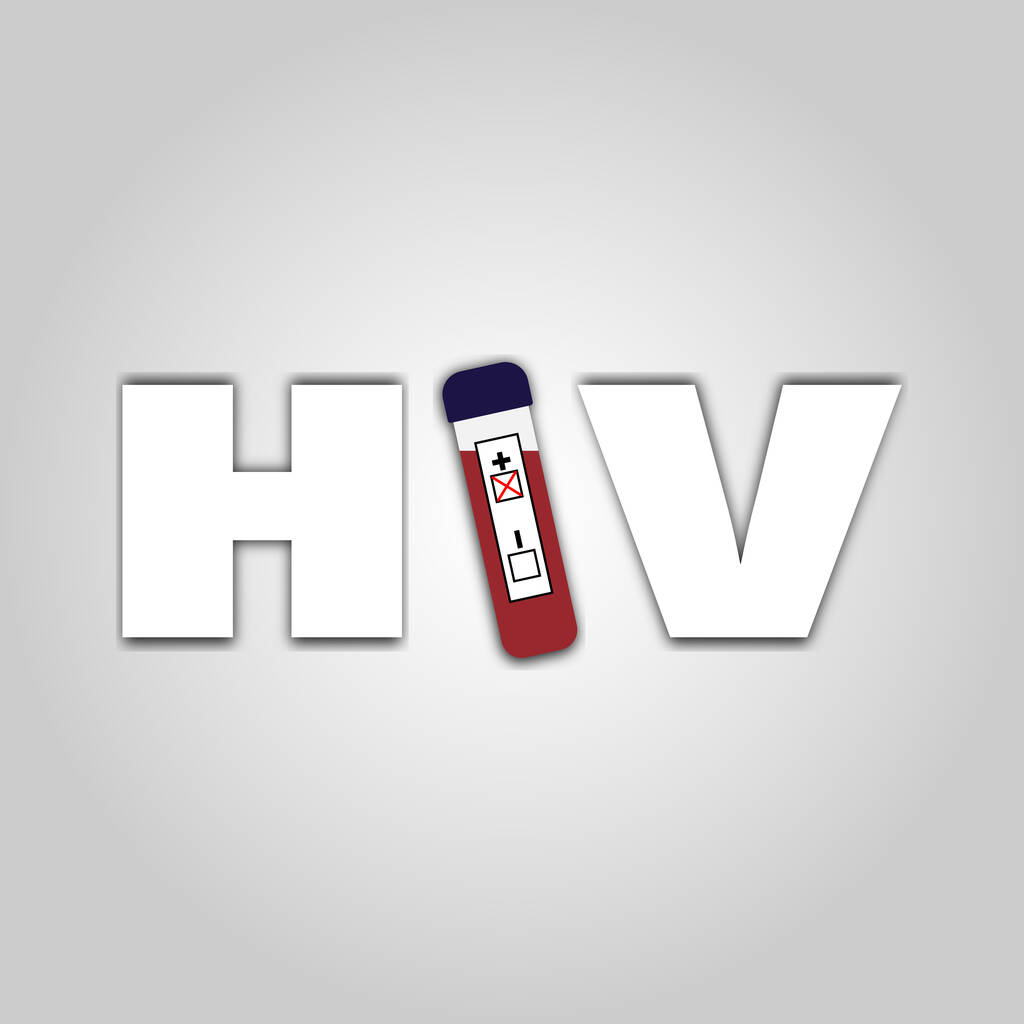 用试管而不是用字母I标注HIV病毒艾滋病毒和艾滋病阳性检测。世界防治艾滋病日.